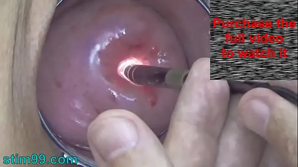 Best Endoscope Camera inside Cervix Cam into Pussy Uterus power Movies